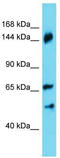 Ankyrin Repeat Domain 18B antibody, TA335323, Origene, Western Blot image 