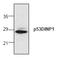 Tumor Protein P53 Inducible Nuclear Protein 1 antibody, AP00101PU-N, Origene, Western Blot image 