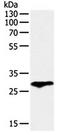 Coagulation Factor III, Tissue Factor antibody, orb107445, Biorbyt, Western Blot image 