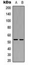 X-Linked Inhibitor Of Apoptosis antibody, abx121816, Abbexa, Western Blot image 