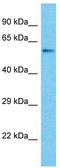 Keratin, type II cytoskeletal 78 antibody, TA337403, Origene, Western Blot image 