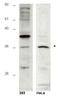 HUS1 Checkpoint Clamp Component B antibody, GTX85658, GeneTex, Western Blot image 