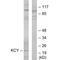 Cytidine/Uridine Monophosphate Kinase 1 antibody, A07962, Boster Biological Technology, Western Blot image 