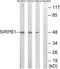 Signal Regulatory Protein Beta 1 antibody, GTX87943, GeneTex, Western Blot image 