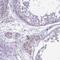 HEAT repeat-containing protein 1 antibody, PA5-61371, Invitrogen Antibodies, Immunohistochemistry frozen image 