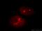 NOP2/Sun RNA Methyltransferase 2 antibody, 20854-1-AP, Proteintech Group, Immunofluorescence image 