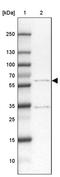 OMA1 Zinc Metallopeptidase antibody, PA5-63067, Invitrogen Antibodies, Western Blot image 