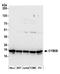 Cytochrome B5 Type B antibody, A305-575A, Bethyl Labs, Western Blot image 