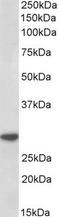 Interleukin 1 Beta antibody, TA334185, Origene, Western Blot image 