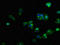 C-X-C Motif Chemokine Receptor 5 antibody, LS-C669810, Lifespan Biosciences, Immunofluorescence image 