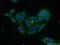 SEC61 Translocon Beta Subunit antibody, 15087-1-AP, Proteintech Group, Immunofluorescence image 
