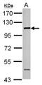 Protein cTAGE-2 antibody, NBP2-14921, Novus Biologicals, Western Blot image 