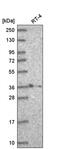 Homeobox B2 antibody, PA5-65483, Invitrogen Antibodies, Western Blot image 