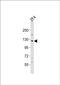 Serine/Threonine Kinase 10 antibody, PA5-72675, Invitrogen Antibodies, Western Blot image 