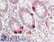 Gasdermin E antibody, LS-B13572, Lifespan Biosciences, Immunohistochemistry paraffin image 