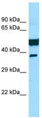 Sterile Alpha Motif Domain Containing 3 antibody, TA334371, Origene, Western Blot image 