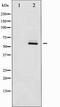 ER-beta antibody, TA327832, Origene, Western Blot image 