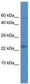 Mitochondrial Ribosomal Protein L21 antibody, TA344024, Origene, Western Blot image 