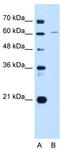Chromatin Licensing And DNA Replication Factor 1 antibody, TA339369, Origene, Western Blot image 