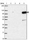 Hexokinase 3 antibody, NBP2-38799, Novus Biologicals, Western Blot image 