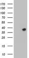 Chromosome 21 Open Reading Frame 62 antibody, TA808845S, Origene, Western Blot image 