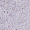 Rho/Rac Guanine Nucleotide Exchange Factor 18 antibody, HPA042689, Atlas Antibodies, Immunohistochemistry paraffin image 