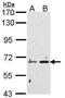 Peptidyl Arginine Deiminase 4 antibody, TA308535, Origene, Western Blot image 