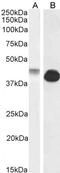 Gap Junction Protein Alpha 1 antibody, LS-C101308, Lifespan Biosciences, Western Blot image 