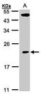 TP53RK Binding Protein antibody, TA308096, Origene, Western Blot image 
