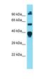 Diacylglycerol O-Acyltransferase 1 antibody, orb331229, Biorbyt, Western Blot image 