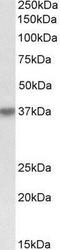 Hematopoietic SH2 domain-containing protein antibody, NBP1-52023, Novus Biologicals, Western Blot image 