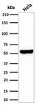 Heat Shock Protein Family D (Hsp60) Member 1 antibody, GTX02649, GeneTex, Western Blot image 