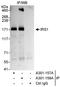 Insulin Receptor Substrate 1 antibody, A301-157A, Bethyl Labs, Immunoprecipitation image 