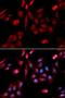 Ran GTPase Activating Protein 1 antibody, LS-C334026, Lifespan Biosciences, Immunofluorescence image 