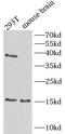 TSC22 Domain Family Member 3 antibody, FNab03455, FineTest, Western Blot image 