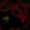 Inner Centromere Protein antibody, HPA070550, Atlas Antibodies, Immunocytochemistry image 
