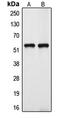 Cytochrome P450 Family 39 Subfamily A Member 1 antibody, LS-C353433, Lifespan Biosciences, Western Blot image 