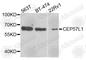 Centrosomal Protein 57 Like 1 antibody, A8290, ABclonal Technology, Western Blot image 