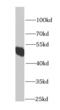 Histidyl-TRNA Synthetase 2, Mitochondrial antibody, FNab03759, FineTest, Western Blot image 