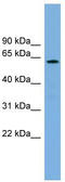 Cytochrome P450 Family 26 Subfamily B Member 1 antibody, TA344813, Origene, Western Blot image 