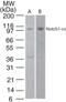 Notch Receptor 1 antibody, PA5-23181, Invitrogen Antibodies, Western Blot image 