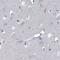 Sodium/hydrogen exchanger 3 antibody, NBP1-82575, Novus Biologicals, Immunohistochemistry paraffin image 