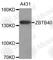 Zinc Finger And BTB Domain Containing 40 antibody, A3662, ABclonal Technology, Western Blot image 