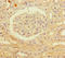 Patatin Like Phospholipase Domain Containing 1 antibody, LS-C397579, Lifespan Biosciences, Immunohistochemistry paraffin image 