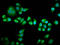 Ras And Rab Interactor 3 antibody, LS-C681211, Lifespan Biosciences, Immunofluorescence image 