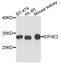 Eukaryotic Translation Initiation Factor 4E Family Member 2 antibody, A4305, ABclonal Technology, Western Blot image 