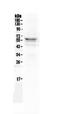 LYN Proto-Oncogene, Src Family Tyrosine Kinase antibody, A01424-2, Boster Biological Technology, Western Blot image 