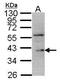 Dual specificity protein phosphatase 12 antibody, GTX109287, GeneTex, Western Blot image 