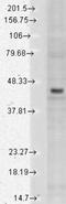 Potassium Voltage-Gated Channel Subfamily J Member 4 antibody, NBP2-12902, Novus Biologicals, Western Blot image 