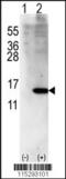 ISG15 Ubiquitin Like Modifier antibody, TA302035, Origene, Western Blot image 